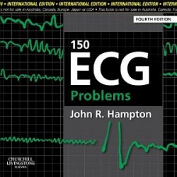 150 ECG Problems, International Edition, 4th Edition